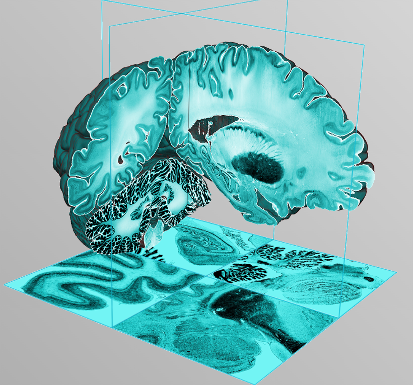 BigBrain 3D Model